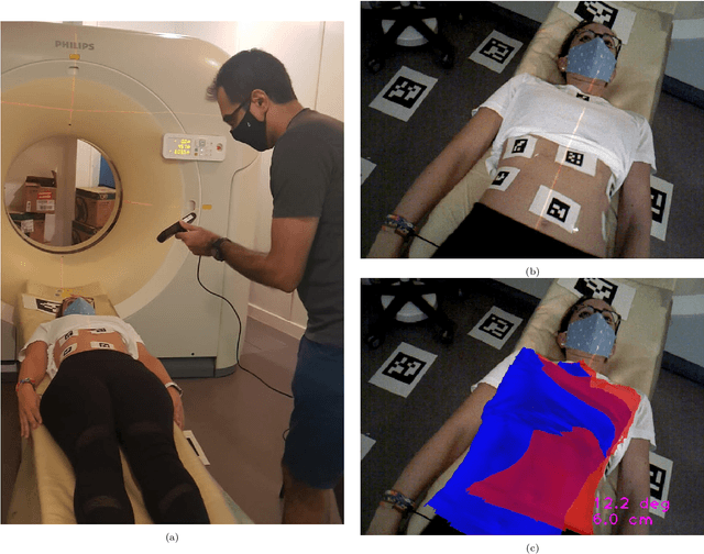 Figure 1 for Joint Scene and Object Tracking for Cost-Effective Augmented Reality Assisted Patient Positioning in Radiation Therapy