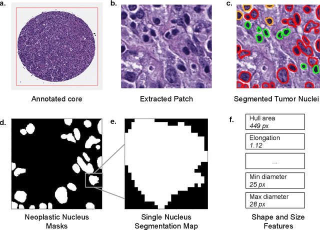 Figure 1 for DLBCL-Morph: Morphological features computed using deep learning for an annotated digital DLBCL image set