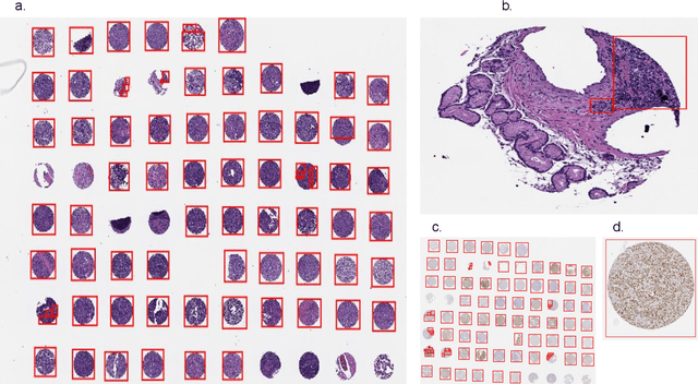 Figure 2 for DLBCL-Morph: Morphological features computed using deep learning for an annotated digital DLBCL image set