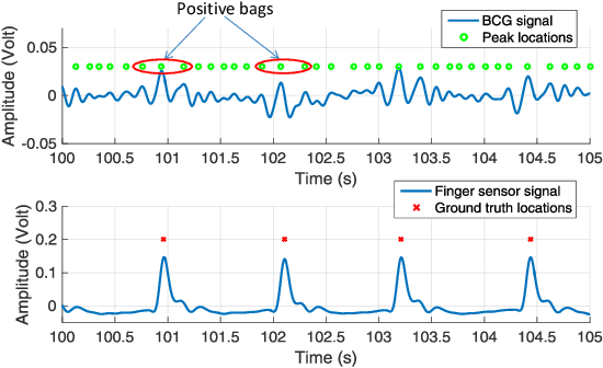 Figure 4 for Heart Beat Characterization from Ballistocardiogram Signals using Extended Functions of Multiple Instances