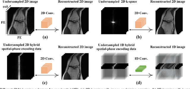 Figure 2 for One-dimensional Deep Low-rank and Sparse Network for Accelerated MRI