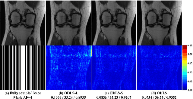 Figure 4 for One-dimensional Deep Low-rank and Sparse Network for Accelerated MRI