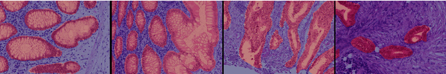 Figure 3 for Negative Evidence Matters in Interpretable Histology Image Classification