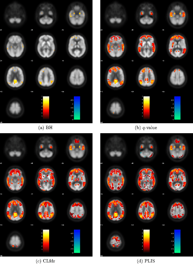 Figure 4 for Multiple Testing for Neuroimaging via Hidden Markov Random Field