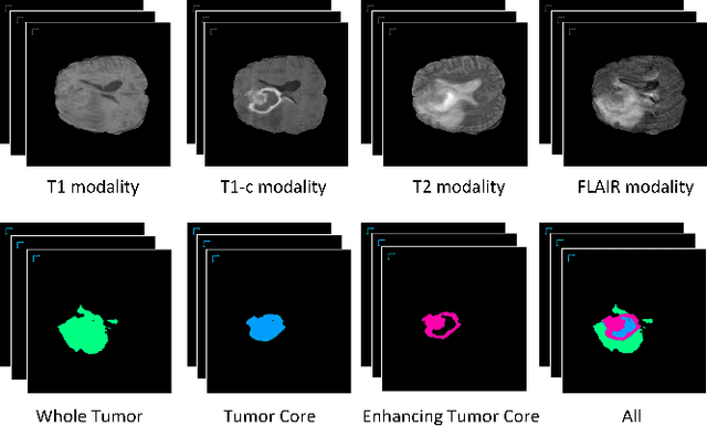 Figure 1 for Cross-Modality Deep Feature Learning for Brain Tumor Segmentation
