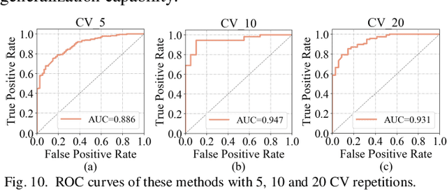 Figure 2 for DC-Al GAN: Pseudoprogression and True Tumor Progression of Glioblastoma multiform Image Classification Based On DCGAN and Alexnet