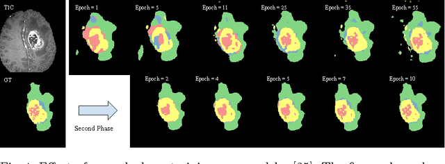 Figure 4 for Deep learning trends for focal brain pathology segmentation in MRI