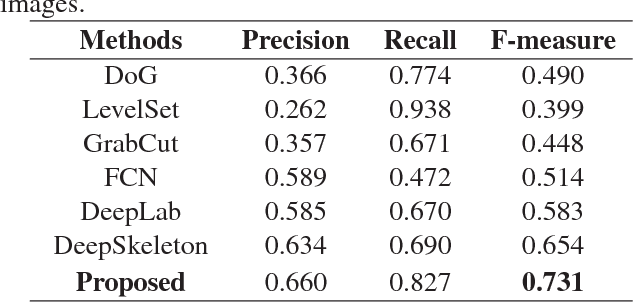 Figure 4 for Curve-Structure Segmentation from Depth Maps: A CNN-based Approach and Its Application to Exploring Cultural Heritage Objects