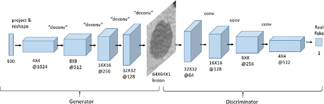 Figure 3 for Synthetic Data Augmentation using GAN for Improved Liver Lesion Classification