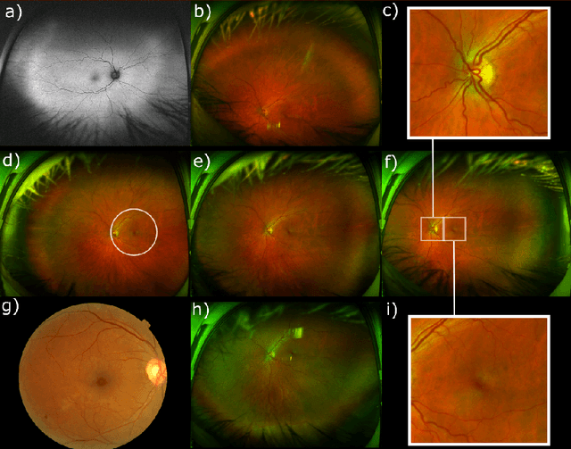 Figure 1 for Optic disc and fovea localisation in ultra-widefield scanning laser ophthalmoscope images captured in multiple modalities