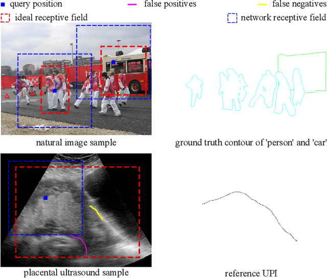 Figure 1 for UPI-Net: Semantic Contour Detection in Placental Ultrasound
