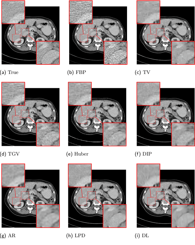 Figure 1 for Deep learning based dictionary learning and tomographic image reconstruction