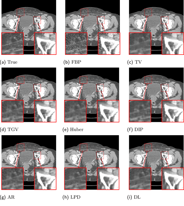 Figure 2 for Deep learning based dictionary learning and tomographic image reconstruction