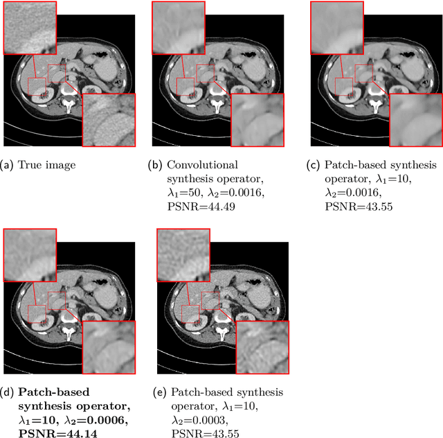 Figure 3 for Deep learning based dictionary learning and tomographic image reconstruction