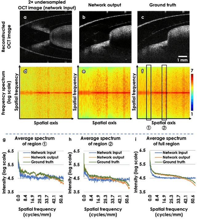 Figure 3 for Neural network-based image reconstruction in swept-source optical coherence tomography using undersampled spectral data