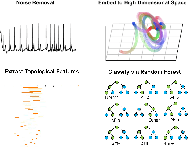 Figure 1 for Classification of Single-lead Electrocardiograms: TDA Informed Machine Learning