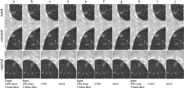 Figure 3 for Using a Generative Adversarial Network for CT Normalization and its Impact on Radiomic Features