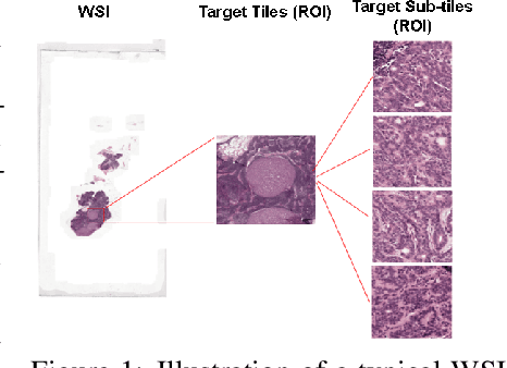 Figure 1 for Efficient Classification of Very Large Images with Tiny Objects