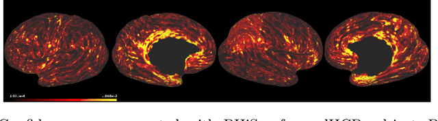 Figure 4 for Surface Agnostic Metrics for Cortical Volume Segmentation and Regression