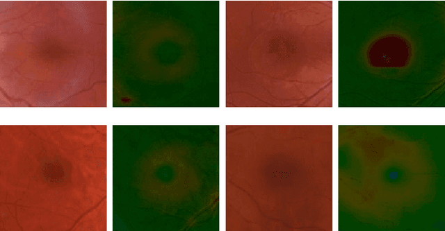 Figure 3 for Heightmap Reconstruction of Macula on Color Fundus Images Using Conditional Generative Adversarial Networks