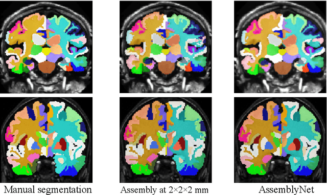 Figure 4 for AssemblyNet: A Novel Deep Decision-Making Process for Whole Brain MRI Segmentation