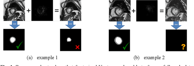 Figure 1 for The Domain Shift Problem of Medical Image Segmentation and Vendor-Adaptation by Unet-GAN
