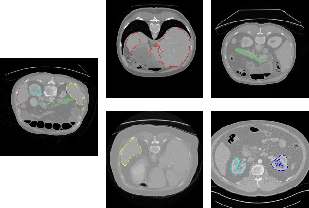 Figure 1 for Marginal loss and exclusion loss for partially supervised multi-organ segmentation