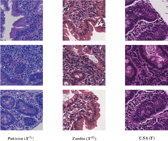 Figure 2 for Self-Attentive Adversarial Stain Normalization