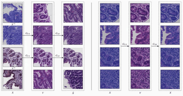 Figure 3 for Self-Attentive Adversarial Stain Normalization