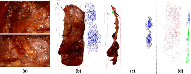 Figure 3 for Real-time Dense Reconstruction of Tissue Surface from Stereo Optical Video