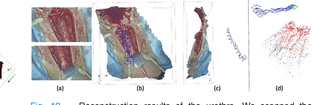 Figure 4 for Real-time Dense Reconstruction of Tissue Surface from Stereo Optical Video