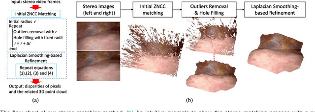 Figure 1 for Real-time Dense Reconstruction of Tissue Surface from Stereo Optical Video