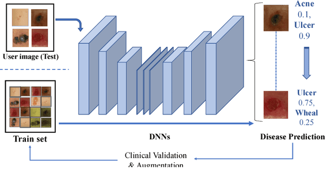 Figure 1 for Supervised classification of Dermatological diseases by Deep learning