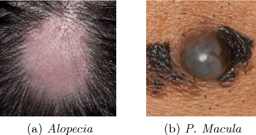 Figure 3 for Supervised classification of Dermatological diseases by Deep learning