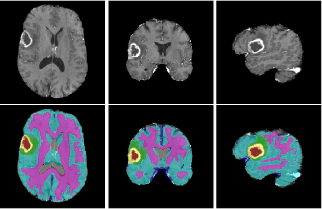 Figure 4 for A Novel Domain Adaptation Framework for Medical Image Segmentation