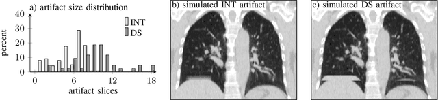 Figure 2 for Deep learning-based conditional inpainting for restoration of artifact-affected 4D CT images