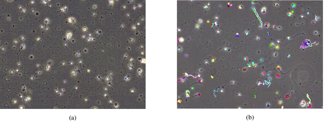 Figure 1 for A Machine Learning Framework for Automatic Prediction of Human Semen Motility