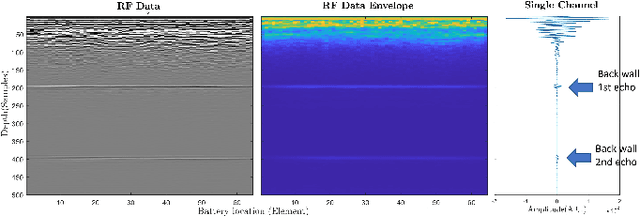 Figure 2 for Noninvasive ultrasound for Lithium-ion batteries state estimation