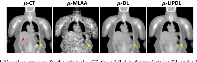 Figure 3 for A Novel Loss Function Incorporating Imaging Acquisition Physics for PET Attenuation Map Generation using Deep Learning