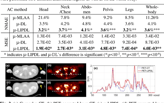 Figure 4 for A Novel Loss Function Incorporating Imaging Acquisition Physics for PET Attenuation Map Generation using Deep Learning