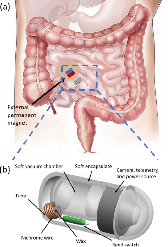 Figure 1 for A Magnetically-Triggered Soft Capsule for On-Demand Mucus Collection