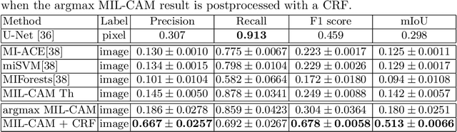 Figure 4 for Weakly Supervised Minirhizotron Image Segmentation with MIL-CAM