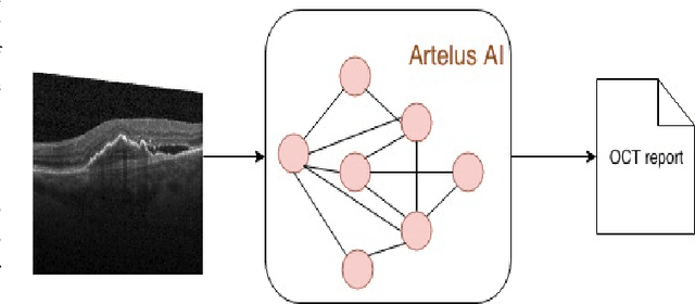 Figure 1 for Towards Ophthalmologist Level Accurate Deep Learning System for OCT Screening and Diagnosis