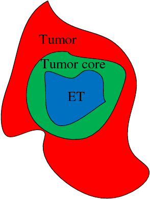 Figure 3 for Hierarchical multi-class segmentation of glioma images using networks with multi-level activation function