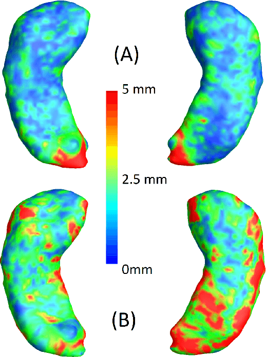 Figure 4 for Image Registration and Predictive Modeling: Learning the Metric on the Space of Diffeomorphisms
