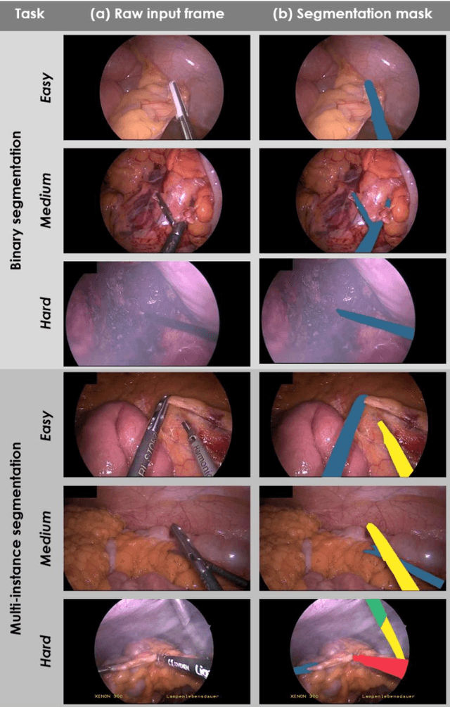 Figure 2 for Heidelberg Colorectal Data Set for Surgical Data Science in the Sensor Operating Room