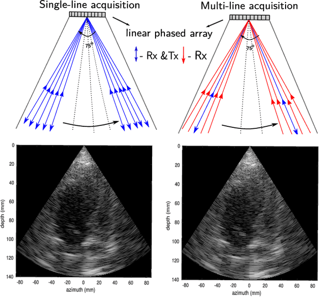 Figure 1 for High frame-rate cardiac ultrasound imaging with deep learning