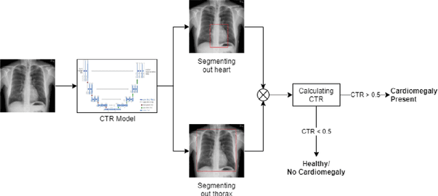 Figure 3 for Deep Learning Models for Calculation of Cardiothoracic Ratio from Chest Radiographs for Assisted Diagnosis of Cardiomegaly