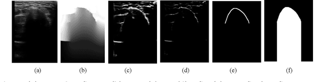 Figure 1 for Simultaneous Bone and Shadow Segmentation Network using Task Correspondence Consistency