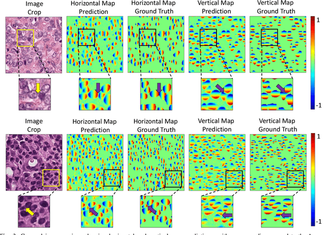 Figure 3 for XY Network for Nuclear Segmentation in Multi-Tissue Histology Images